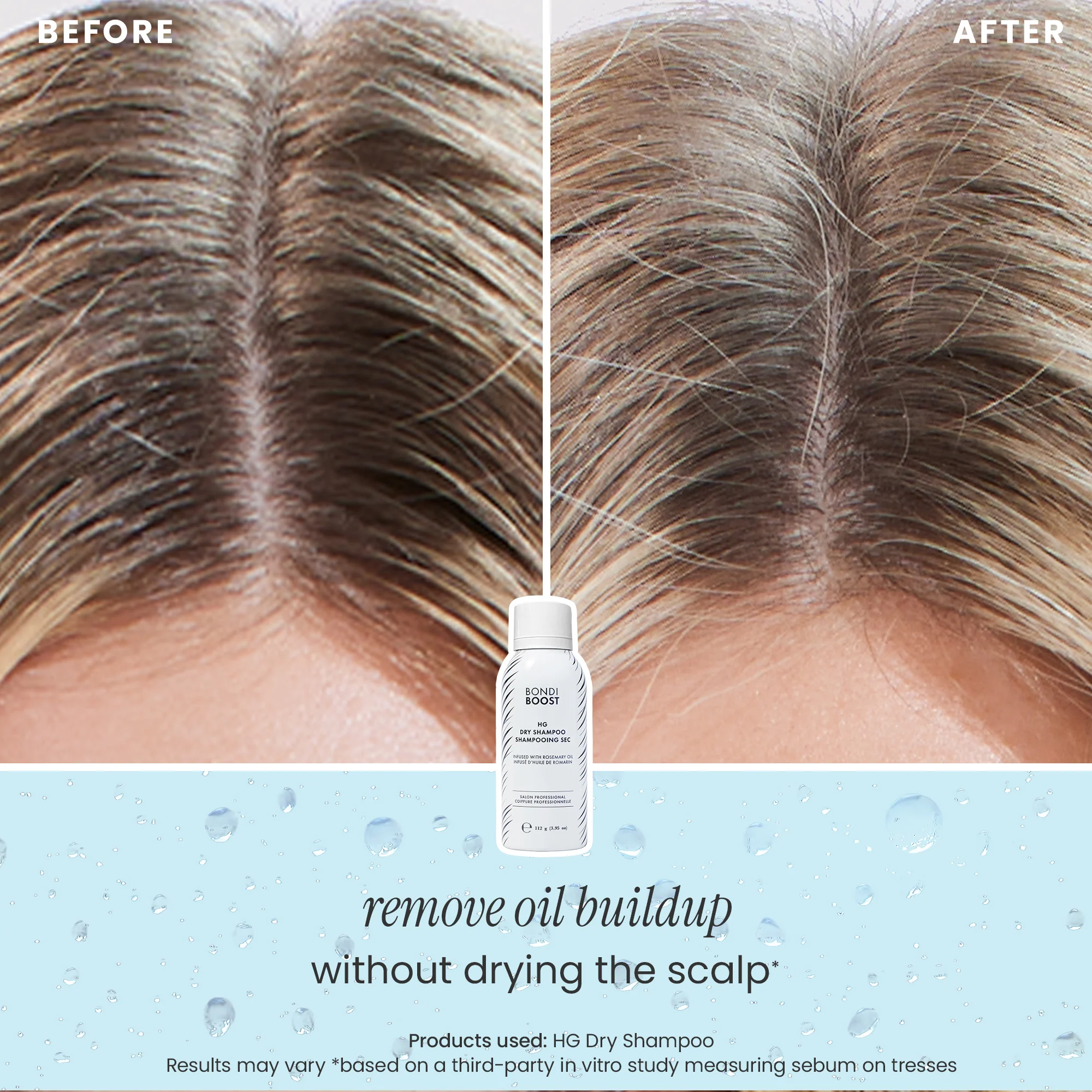 DRY SHAMPOO - 3 PACK - Image 4
