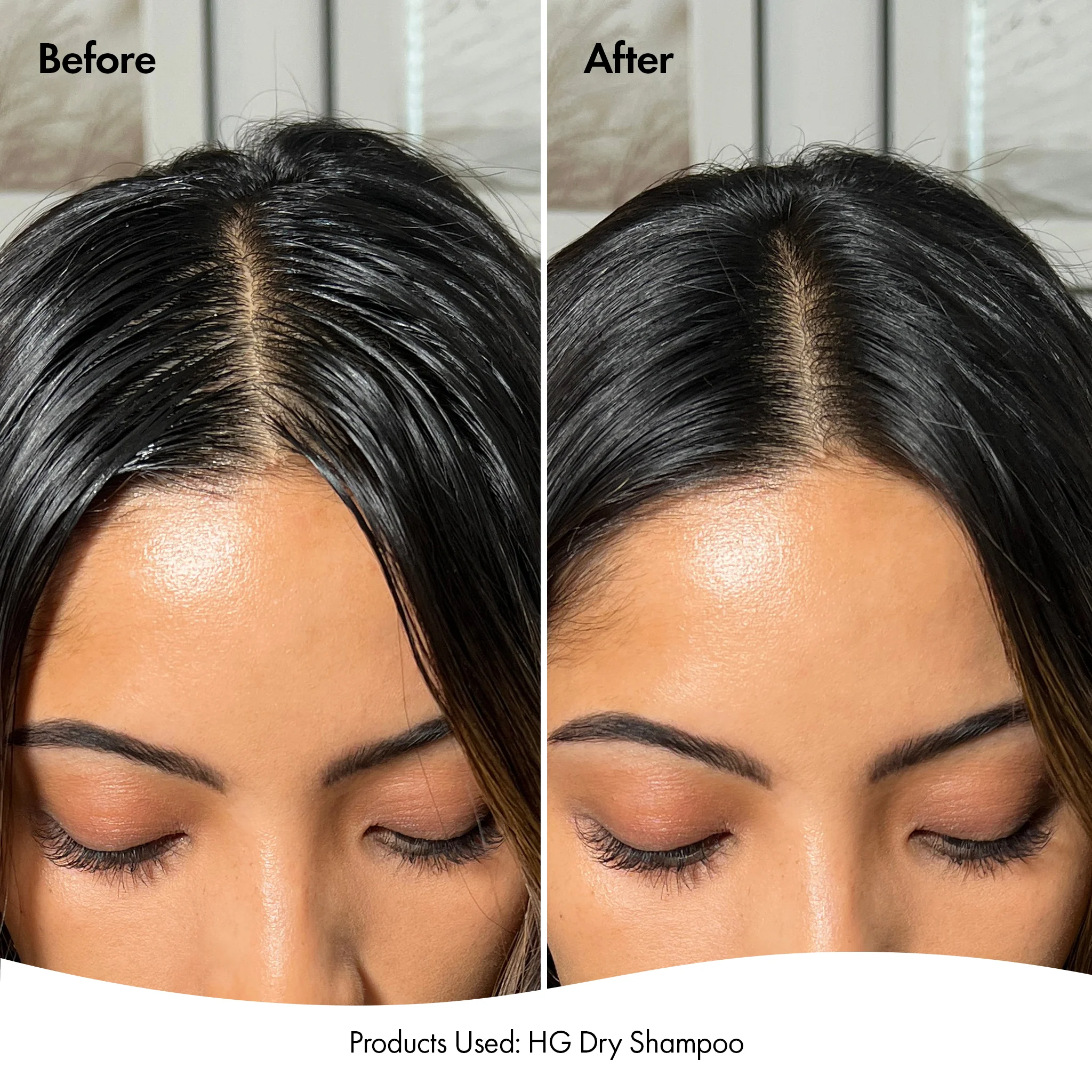 DRY SHAMPOO DUO - Image 4