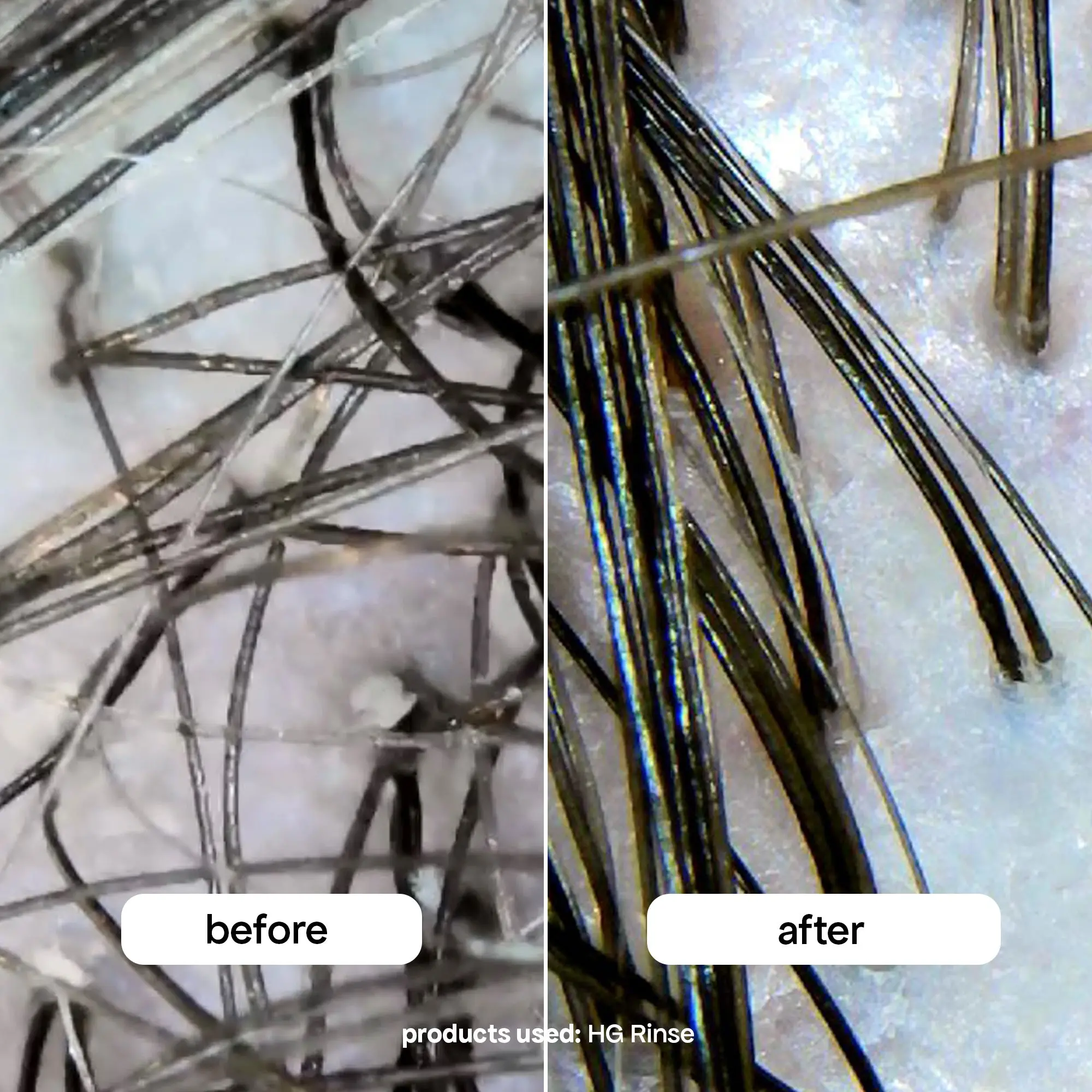 HAIR EXTENSION SYSTEM - Image 3