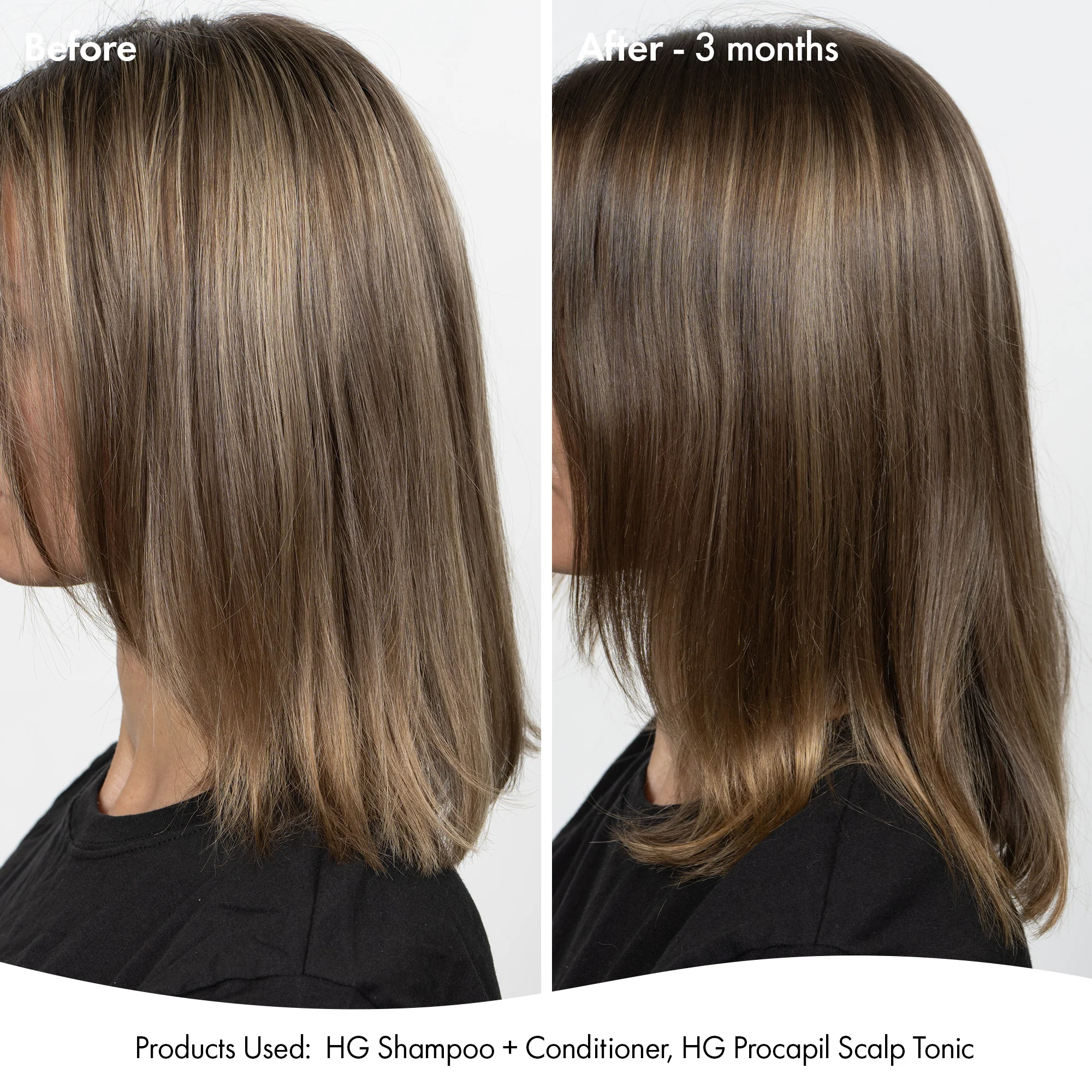 ANTI-THINNING SUPER SYSTEM - Image 4