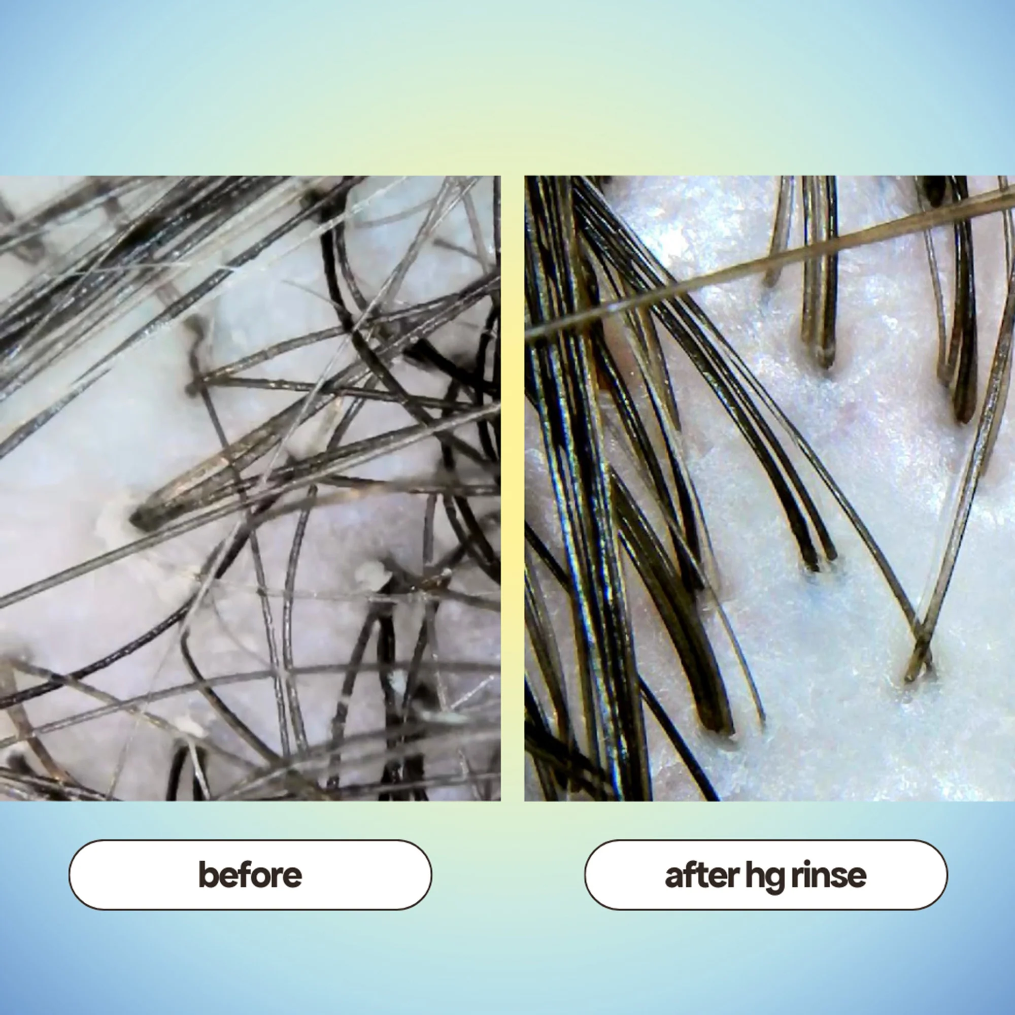 ANTI-THINNING SUPER SYSTEM - Image 7