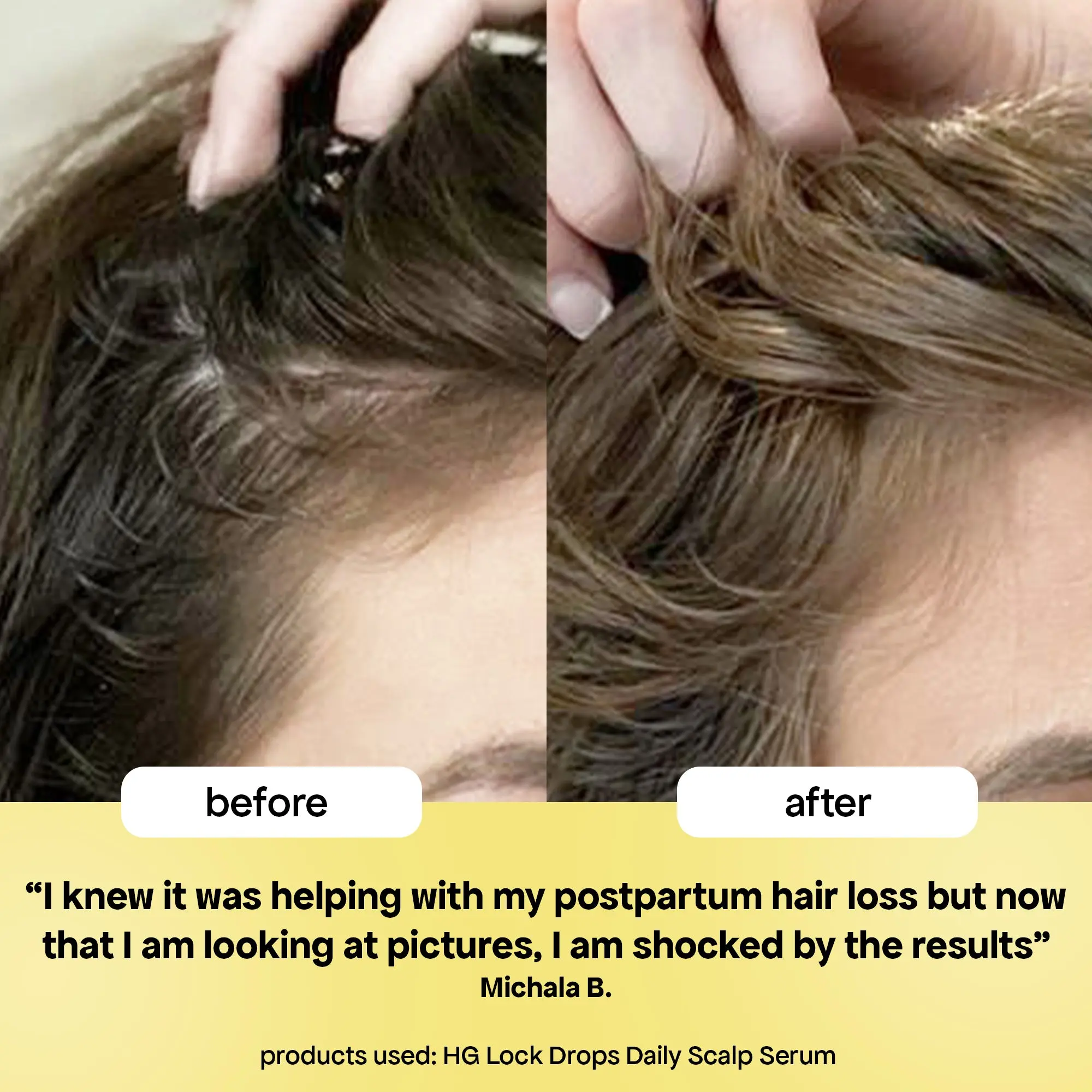 LOCK DROPS ANTI-SHEDDING SCALP & HAIR SERUM - Image 4