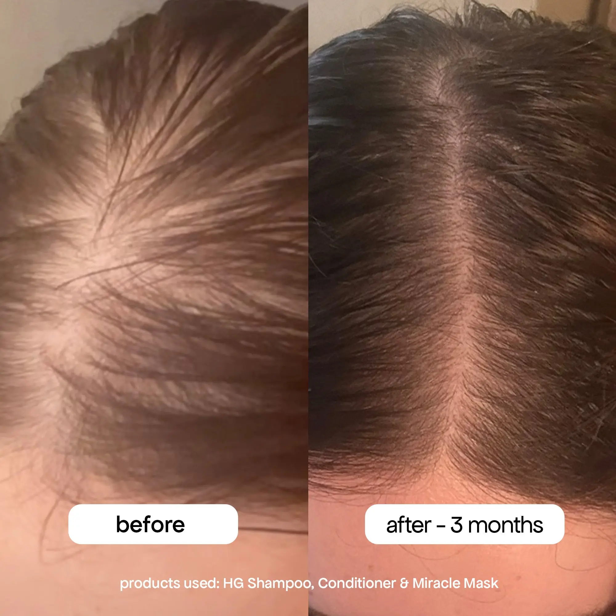 MINI ANTI-THINNING CONDITIONER - Image 9